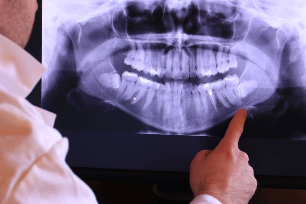 Best Knocked-Out Tooth Emergency  in Governors Clu, NC